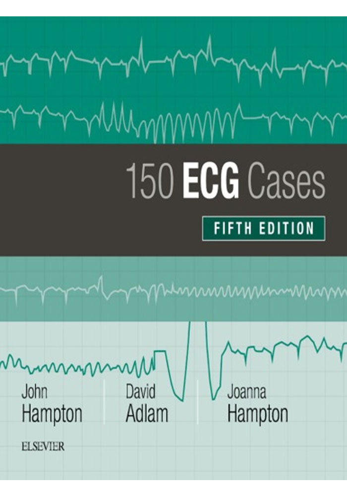 150 ECG Cases 5th Edition