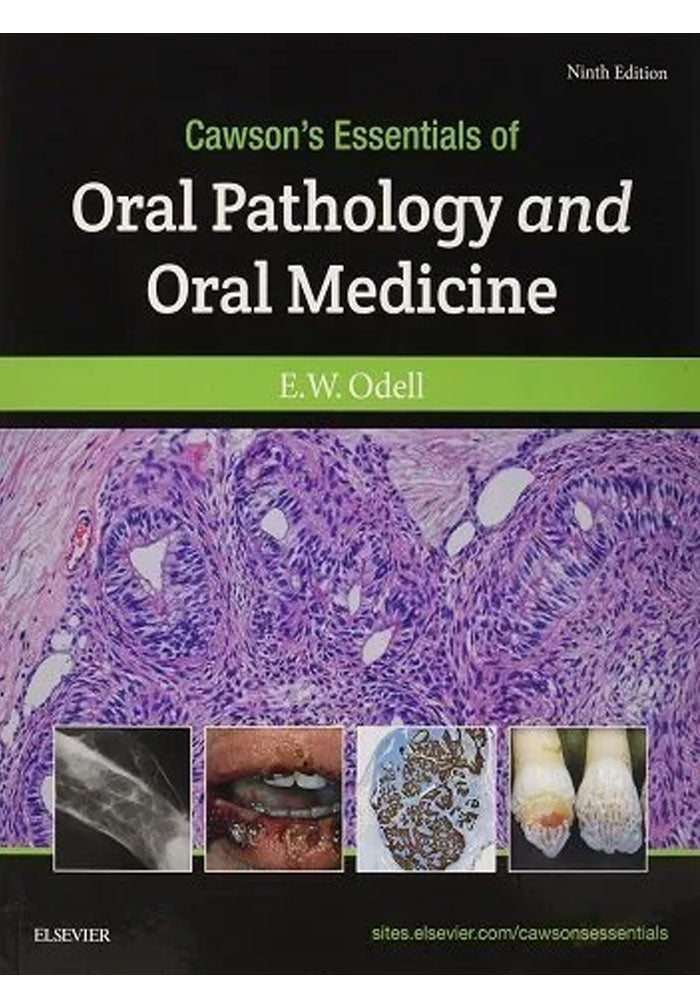 cawson's essentials of oral pathology and oral medicine 9th edition