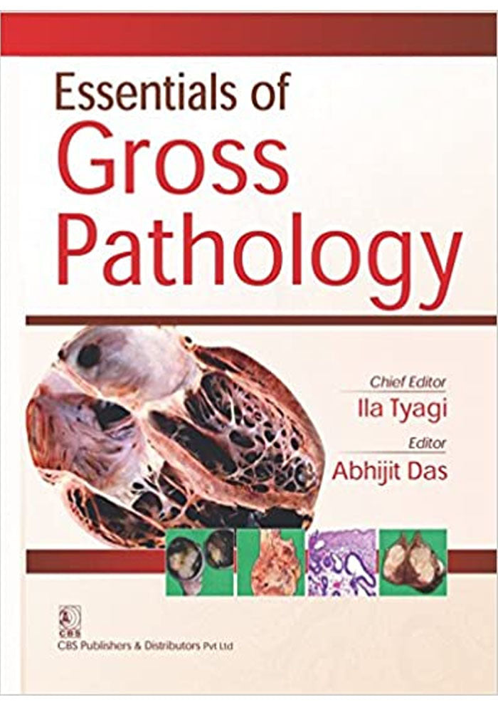 Essential of Gross Pathology 1/e Edition, Kindle Edition