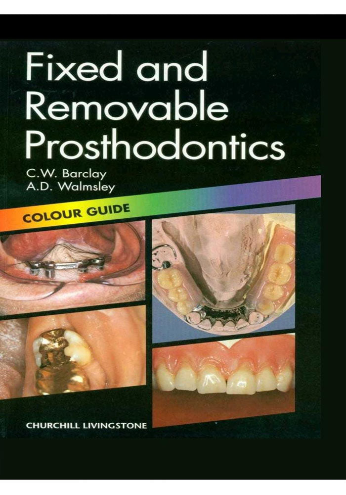 Fixed and Removable Prosthodontics: Color Guide (Color Guides) 2nd Edition